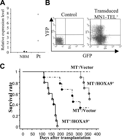 Figure 5. HOXA9 and MN1-TEL cooperatively cause acute myeloid leukemia (AML) in mice. (A) Expression of HOXA9 in AML patient samples with MN1-TEL. A quantitative RT-PCR result is shown. NBM indicates control normal BM (n = 3); and Pt, patient samples (n = 2). (B) Retroviral transduction of MN1-TEL+ BM cells. Sorted MN1-TEL+ or MN1-TEL- Lin- BM cells were transduced with pSRα-HOXA9-IRES-YFP (HOXA9) or pSRα-IRES-YFP (vector) retrovirus. The FCM analysis of GFP/YFP expression in MN1-TEL+ BM cells transduced with HOXA9 virus is shown on the right. Control indicates uninfected WT BM cells. (C) Survival analysis. Retrovirally transduced BM cells (MN1-TEL+/HOXA9+, MN1-TEL+/Vector, MN1-TEL-/HOXA9+, MN1-TEL-/Vector) were transplanted into lethally irradiated syngeneic recipients (n = 10 in each group). Survival curves were generated by the Kaplan-Meier method. ○ indicates AML; and •, T-lymphoid leukemia.