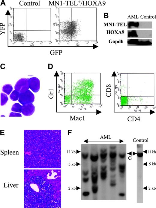 Figure 6. Characteristics of AML caused by MN1-TEL+/HOXA9+ BM cells. (A) GFP and YFP expression in AML cells. BM cells of mice that received leukemic MN1-TEL+/HOXA9 transplants were analyzed by FCM. (B) Expression of MN1-TEL and HOXA9 in AML cells. Western blot of BM cells was incubated with TEL C-terminal or FLAG (for HOXA9) antibody. Gapdh detection was used as a loading control. Control indicates untransduced normal BM. (C) M-G staining of AML cells. Images were obtained as previously described.12 (D) Surface marker analysis of AML cells by FCM. (E) Aggressive organ infiltration of AML cells. H-E staining of liver and spleen sections is shown. (F) Clonality of AML cells. Genomic DNA of AML cells was digested with BglII and hybridized with a HOXA9 probe. Control indicates untransduced BM; and G, germ line band.