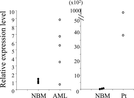 Figure 7. Elevated expression of N-Myc in human and mouse MN1-TEL+/HOXA9+ AML. A quantitative RT-PCR result is shown. (Left) Expression of N-Myc mRNA in mouse MN1-TEL+/HOXA9+ AML cells (BM); (right) expression of N-MYC mRNA in 2 human MN1-TEL AML patient samples. NBM indicates control normal BM (n = 3); and Pt, patient samples (n = 2).