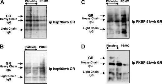 Figure 7. Detection of GR-associated proteins in human platelets. PRP extracts were immunoprecipitated with specific antibodies to (A) HSP70, (B) HSP90, (C) FKBP51, or (D) FKBP52 as described in “Materials and methods,” and WB analysis for GR was applied to reveal direct protein association. PBMC extracts, prepared from the same donors, were run in parallel. Blots are representative of 4 distinct experiments.
