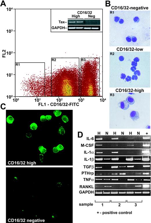 Figure 3. Isolated Tax tumor cells express transcripts for osteoclast-activating factors. (A) Single-cell suspensions of 3 Tax+ tumors were sorted by FACS according to FcγR II/III (CD16/CD32) FITC-negative, -low, and -high intensity. Expression of the Tax gene was detected in CD16/CD32-high but not in -negative cell populations by RT-PCR. GAPDH was used as an internal control. (B) Cytospin and Wright-Giemsa-Grünwald staining was performed on sorted cells. CD16/CD32 FITC-negative cells were normal lymphocytes/stromal cells. CD16/CD32 FITC-high cells were tumor cells, whereas CD16/CD32 FITC-low cells were neutrophils (× 20). (C) CD16/CD32 FITC-high cells were immunofluorescently stained with Tax antibody (green, × 20). (D) RT-PCR of selected osteoclast-activating factors in CD16/CD32 FITC-negative (N) and FITC-high (H) cells was performed on the mRNA of purified cell types isolated from whole tumors. RANKL was expressed in CD16/CD32 lymphocytes/stromal cells; IL-6, IL-1α, and M-CSF were expressed in Tax tumor cells; IL-1β, TGFβ, PTHrP, and TNFα were expressed in both CD16/CD32-negative and -high cell populations.