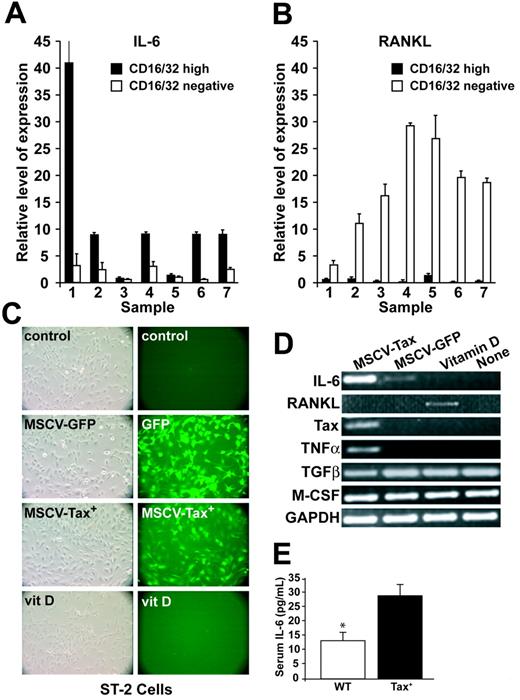 Figure 4. Tax induces IL-6 expression in tumor cells. (A-B) Real-time RT-PCR of IL-6 and RANKL normalized to GAPDH from 7 CD16/CD32-fractionated Tax tumors from 7 mice. RANKL was expressed in normal lymphocytes/stromal cells, whereas IL-6 was expressed in Tax tumor cells. All data are depicted as the mean ± SEM. (C) The preosteoblast cell line ST-2 was transduced with MSCV-Tax-GFP or MSCV-GFP. Controls were nontreated ST-2 cells and ST-2 cells treated with vitamin D for 3 days. Left panel pictures were taken under phase contrast microscopy; right panel pictures were taken under FITC channel of conventional fluorescent microscopy. (D) MSCV-Tax transduction in ST-2 cells induces IL-6 and TNFα expression but not RANKL. RT-PCR of selected osteoclast-activating factors was performed on cDNAs from transduced ST-2 cells, vitamin D–treated ST-2 cells, and nontreated ST-2 cells. (E) Serum was obtained retroorbitally, and IL-6 levels were determined by ELISA. Results for Tax+ (n = 17) and wild-type (n = 19) mice are shown as picogram per milliliter. Tax+ mice have increased serum IL-6 levels (P < .05). Values are depicted as the mean ± SEM.