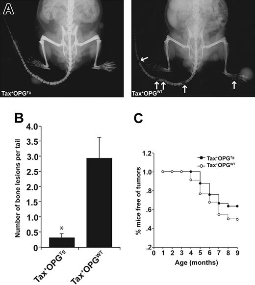 Figure 5. Tax+OPGTg mice are protected from osteolytic bone lesions and soft tissue tumor development. Tax+ mice were crossed with OPGTg mice. Tax+OPGTg mice (n = 33) and Tax+OPGWT (n = 22) littermates were evaluated weekly for peripheral tumor formation, and radiographic images were taken at 3, 6, and 9 months of age. Experiments were ended when mice were 9 months old. (A) Representative radiographic images of a Tax+OPGTg mouse and a Tax+OPGWT mouse at 9 months of age. Tax+OPGWT mouse demonstrates osteolytic bone lesions on the tail vertebrae (arrows). (B) In mice that developed osteolysis, Tax+OPGWT mice show significantly increased bone lesions on the tail vertebrae (P < .01) compared with Tax+OPGTg. Bone lesion number is depicted as the mean ± SEM. (C) Tax+OPGTg mice are protected from the development of soft-tissue tumors (P < .01, by a paired t test in SigmaPlot 2001 version 9; Systat Software, Point Richmond, CA).