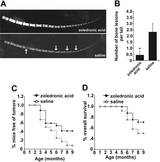 Figure 6. Early bisphosphonate treatment prevents osteolytic bone lesions and enhances overall survival in Tax+ mice. Tax+ littermate mice were randomly divided into zoledronic acid–treated (0.75 μg per mouse subcutaneous injection weekly, n = 17) or saline controls (n = 12) at 1 month of age. Mice were evaluated biweekly for peripheral tumor formation, and radiographic images were taken at 3, 6, and 9 months of age. Experiments were ended when mice were 9 months old. (A) Representative radiographic images of Tax+ mice treated with zoledronic acid or saline at 9 months of age. Tax+ mice treated with saline show overt bone lesions (arrows). (B) Of the mice that developed osteolysis, numbers of tail lesions are significantly higher in saline-treated mice (P < .05). Bone lesion number is depicted as the mean ± SEM. (C) Tax+ mice treated with zoledronic acid were protected from the development of peripheral tumors (P < .01 by a paired t test in SigmaPlot 2001). (D) Tax+ mice treated with zoledronic acid show increased overall survival (P < .01 by a paired t test in SigmaPlot 2001).