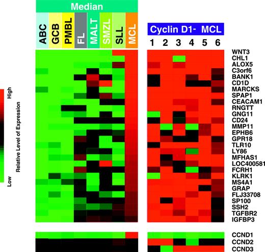 Figure 1. Expression profiles of mantle cell lymphoma (MCL) signature genes in 6 cases of cyclin D1-negative MCL using Affymetrix U133 A/B arrays. These expression profiles are compared with 22 cases of cyclin D1-positive MCL, 78 cases of activated B-cell-like (ABC), 85 cases of germinal center B-cell-like (GCB), and 33 cases of primary mediastinal (PMBL) variants of diffuse large B-cell lymphoma, 193 cases of follicular lymphoma (FL), 14 cases of extranodal marginal zone lymphoma, MALT type (MALT), 6 cases of splenic marginal zone lymphoma (SMZL), and 14 cases of small lymphocytic lymphoma (SLL) (median expression levels of the MCL signature genes in these entities are shown). In the 6 cases of cyclin D1-negative MCL, each column represents a single lymphoma specimen and each row represents the level of expression of a single gene in the MCL signature. Red squares indicate increased expression and green squares indicate decreased expression relative to the median expression level, according to the color scale shown over a 4-fold range. In the bottom panel, the gene expression levels of the D-type cyclins in the various entities and the 6 cases of cyclin D1-negative MCL are shown according to the color scale over a 16-fold range. For microarray data of all cases, refer to Table S1.