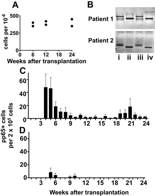Figure 6. Adoptive therapy with recipient-type CMV-specific T-cell clones in CMV-negative donor/CMV-positive recipient transplants. CMV-specific CD4+ T-cell clones were obtained from 2 CMV-positive patients before transplantation from CMV-negative donors. Clones were tested for alloreactivity against donor alloantigens. Those cross-reacting against donor were discarded, and the nonreactive were infused after transplantation. (A) Frequencies of CMV-specific T cells detected in these 2 patients at various time points after adoptive therapy infusion. (B) Donor-versus-recipient chimerism by DNA polymorphism in the 2 transplants. Lane i: donors' PBMCs; lane ii: recipients' pretransplantation PBMCs; lane iii: recipients' posttransplantation PBMCs; and lane iv: recipients' anti-CMV T-cell clones after adoptive therapy. Note, anti-CMV responses (lane iv) were of recipient origin (compare pattern with lane ii), unlike the bulk of the PBMCs (lane iii), which were of donor origin (compare pattern with lane i). (C) CMV antigenemias in 8 control CMV-positive patients who received transplants from CMV-negative donors showing prolonged CMV reactivation. (D) CMV antigenemias in the 2 CMV-positive patients who received transplants from CMV-negative donors who had received adoptive therapy. Note control of CMV reactivation. All data presented as mean ± SD.