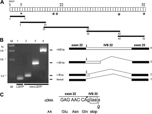 Figure 1. Diagram of α-spectrin gene exons (not to scale) and strategy used to obtain overlapping cDNA fragments, indicated by the black bars. (A) The + indicates the L207P mutation and the asterisks indicate single nucleotide polymorphisms (SNPs) used as linkage markers to distinguish between the 2 α-spectrin alleles in the subcloned amplified cDNA fragments. (B) Reamplification of PCR products from different subclones of the exon 15 to 32 cDNA fragment, using primers to encompass exons 22 and 23. All subclones of the L207P allele had a normal-sized band (no. 1). However, subclones of the non-L207P allele demonstrated 3 different higher molecular weight bands corresponding to fragments with incremental sizes of 36, 260, or 620 bp (nos. 2, 3, and 4, respectively). M indicates size markers. To the right of the gel are diagrams of the different splicing isoforms, with insertions derived from the 5′ end of IVS 22 (open bar). The arrow indicates the in-frame stop codon located at the very 5′ end of the retained intronic sequence. (C) Nucleotide sequence at the junction of exon 22 and IVS 22 in the cDNAs corresponding to the non-L207P allele of the HPP proband. The encoded amino acid sequence is shown below the sequence, and the exon/intron junction is indicated by the arrowhead above the sequence. The in-frame termination codon is shown in the box.