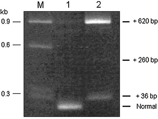 Figure 2. RT-PCR products, obtained using primers encompassing exons 22 and 23, of RNA extracted from Cos-7 cells transfected with minigene expression constructs containing either the normal or mutant IVS 22 donor splice site. The RT-PCR product derived from RNA of cells expressing the wild-type construct (lane 1) had a predominant band of normal size. The RT-PCR product derived from RNA of cells expressing the IVS 22 mutant construct (lane 2) yielded no visible normally sized band but, instead, displayed 2 prominent higher molecular weight bands, corresponding to fragments with incremental sizes of 36 and 620 bp and a faint band of incremental size of 260 bp. The sequence composition of the different products was verified by sequencing and shown to be concordant with the splicing events illustrated in Figure 1B. M indicates size markers.