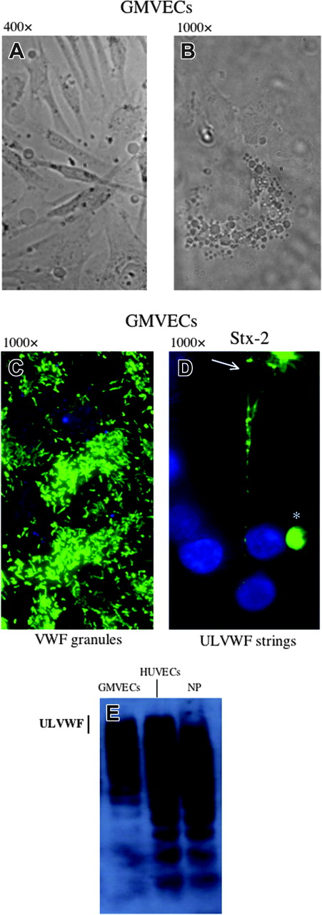 Figure 3. GMVECs. The cells were passage 4, grown on glass coverslips. Bright field images at different magnifications show elongated cells (A; original magnification × 400) and the rounded central portion of a single cell (B; original magnification × 1000). (C-D) GMVECs were stained with rabbit anti-VWF IgG and goat anti-rabbit-IgG-Alexa 488 (green), as well as the nuclear stain, DAPI (blue). The unstimulated GMVECs contain cytoplasmic VWF-containing granules (C). The granules are secreted as long ULVWF multimeric strings (D) in response to stimulation of the GMVECs for 3 minutes with Stx-2 (1 nM). The ULVWF strings frequently become entangled, as at the top of the frame (arrow). In some Stx-1- or Stx-2-stimulated GMVECs at passage number 4 (or higher), circular conglomerates of surface VWF (*) that do not unfurl into strings in response to stimulation are also seen. (E) VWF multimers enriched in ULVWF are also released slowly into the culture medium in soluble form by unstimulated GMVECs over the course of 24 hours. The VWF multimers were separated by 1% agarose/SDS gel electrophoresis, and then detected by membrane transfer, a polyclonal rabbit anti-VWF IgG, goat anti-rabbit IgG-HRP and chemiluminescence. VWF released from unstimulated HUVECs over 24 hours, or present in normal human platelet-poor plasma (NP), are shown for comparison. The vertical line indicates the gel location of ULVWF forms. These photos are representative of 3 experiments.