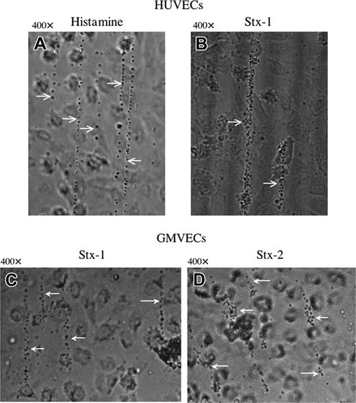 Figure 4. Platelets attach to ULVWF strings secreted from HUVECs or GMVECs stimulated by histamine in millimolar or Stxs in nanomolar concentrations. Washed normal human platelets in Ca2+/Mg2+-free Tyrode buffer were perfused over HUVECs (A-B) or GMVECs (C-D) and attached to the ULVWF strings formed as a result of cell stimulation by 20 mM histamine (A), or 10 nM of either Stx-1 (B-C) or Stx-2 (D). White arrows point to ULVWF strings with adherent platelets. Photographs of ULVWF-platelet strings were taken under flowing conditions 2 minutes after HUVEC stimulation. Each of these photos is representative of 3 to 20 experiments.