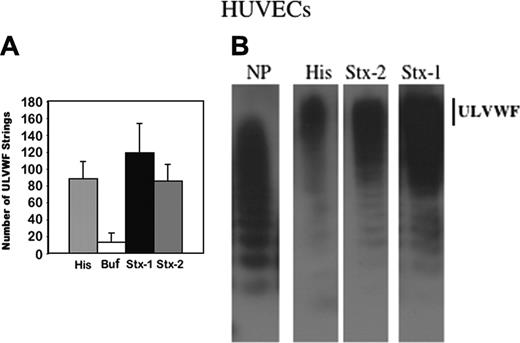 Figure 5. HUVECs produce similar quantities of ULVWF strings following stimulation by histamine in millimolar or Stxs in nanomolar concentrations. (A) HUVECs were incubated with histamine, buffer, or 10 nM Stx-1 or Stx-2 prior to perfusion with washed normal human platelets in Ca+2/Mg+2-free Tyrode buffer. The number of VWF-platelet strings formed in 20 microscope fields at × 400 magnification was quantified after 2 minutes of flow (n = 10-20). (B) In separate experiments, the multimeric patterns of VWF secreted into culture media were compared following HUVEC stimulation for 5 minutes with histamine (His, 20 mM) or Stx-2 or Stx-1 (10 nM). Separation and detection of VWF multimers were as described in Figure 3. The VWF multimeric pattern in normal plasma (NP) is shown for comparison. The vertical line indicates the location of ULVWF forms (n = 10-15).