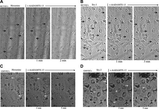 Figure 8. Stx-1 and Stx-2 inhibit ULVWF-platelet string cleavage by rhADAMTS13. Washed normal human platelets in Ca+2/Mg+2-free Tyrode buffer were perfused continuously over HUVECs (A-B) or GMVECs (C-D) that had been stimulated for 10 minutes with histamine (20 mM; A,C), Stx-1 (10 nM; B) or Stx-2 (10 nM; D). ULVWF-platelet strings formed during the initial 2 minutes were photographed in a single field in the next 2 minutes. Washed platelets in buffer containing rhADAMTS13 (1:10 dilution; no additional histamine or Stx) were then perfused over the endothelial cells, and the ULVWF-platelet strings were photographed repeatedly in the same microscopic field (original magnification × 400) at the time intervals shown. A vertical line indicates the addition of rhADAMTS13. Arrows indicate ULVWF-platelet strings that were cleaved by rhADAMTS13 in about 2 minutes during the perfusion of endothelial cells that had been stimulated previously by 20 mM histamine (A,C), but persisted for more than 3 to 5 minutes (> 10 minutes in many experiments) during the perfusion of endothelial cells that had been stimulated previously by 10 nM Stx-1 (B) or Stx-2 (D). Each of these photos is representative of 3 to 20 experiments.