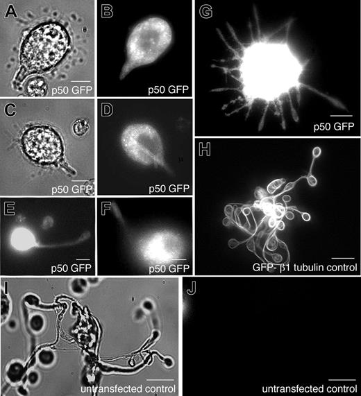 Figure 8. Role of dynactin in proplatelet elongation. (A-J) Effects of p50 dynamitin expression on proplatelet elongation. (A,C) Differential-interference-contrast and (B,D-G) fluorescence images of p50-GFP–expressing cells exhibiting a range of elongation distortions, compared with the unperturbed elongation of representative megakaryocytes (H) retrovirally directed to express GFP–β1-tubulin and (I-J) uninfected, nonexpressing cells. All images were acquired by fluorescence and DIC microscopy. Scale bars all represent 10 μm.