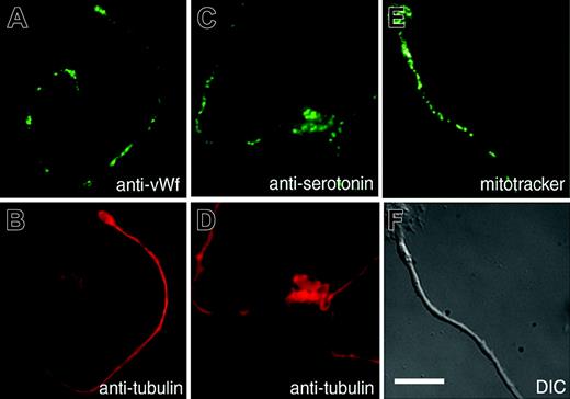 Figure 1. Megakaryocyte organelles and granules distribute individually in proplatelets to assembling platelets. Localization of organelles in the proplatelets of mouse megakaryocytes. Proplatelets were stained with anti-von Willebrand factor56 (A) to label α-granules, antiserotonin (C) to label dense granules, and MitoTracker (E) to label mitochondria. Corresponding antitubulin immunofluorescence (B,D) and differential-interference-contrast (F) micrographs highlight the proplatelet morphology. Scale bar, 10 μm. Granules and mitochondria are dispersed along the proplatelet shaft.