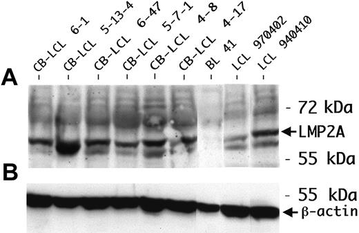 Figure 1. LMP2A expression in CB-LCLs. (A) LMP2A protein expression was determined by Western blot analysis. The peripheral blood B-cell–derived LCL 970402 and LCL 940410 were used as positive controls. The protein lysate of the EBV-negative cell line BL41 was blotted as a negative control. All LCLs analyzed were consistently positive for LMP2A. (B) β-actin was used as a loading control.