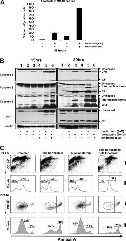 Figure 3. Demonstration of synergistic apoptosis induction as measured by annexin V staining in cell lines and primary human myeloma cells that is associated with rapid caspase cleavage. (A) MM.1R cells were plated and concurrently treated with bortezomib (8 nm) and lonafarnib (5 μM). After 48 hours, cells were pooled and stained with annexin V. The percent annexin V-positive cells is represented as an index of apoptosis for either single-agent or combination therapy. (B) RPMI8226 cells were plated and concurrently treated with bortezomib (8 nM or 20 nM) and lonafarnib (5 μM). After 15 and 30 hours, Western blotting was performed for expression of caspase 8, caspase 9, caspase 3, and PARP. Antibodies were used to evaluate the amount of cleaved and uncleaved forms of these proteins. Lane 1, untreated control; lane 2, 8 nM bortezomib; lane 3, 20 nM bortezomib; lane 4, 5 μM lonafarnib; lane 5, 8 nM bortezomib + 5 μM lonafarnib; lane 6, 20 nm bortezomib + 5 μM lonafarnib. (C) Bone marrow samples collected from MM patients were treated with bortezomib and lonafarnib for 40 hours. Cells were pooled and stained with annexin V and PI as described in “Materials and methods.”