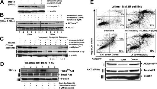 Figure 4. Synergistic apoptosis is associated with down-regulation of p-AKT in cell lines and primary human myeloma cells dependent upon order of addition and can be mimicked with the use of other AKT-specific inhibitors. (A) MM.1R cells were concurrently treated with bortezomib (8 nM or 20 nM) and lonafarnib (5 μM). After 24 hours, the cells were collected, and Western blots were performed with phos-AKT473 antibody. (B) RPMI8226 cells were concurrently treated with bortezomib (8 nM or 20 nM) and lonafarnib (5 μM). After 15 and 30 hours, the cells were collected, and Western blots were performed with Phos-AKT473 antibody in order to determine the time course for p-AKT reduction. (C) Kinase assay for AKT was performed using GSK α and β as a substrate. (D) Primary human MM cells were treated for 18 hours with either single agent or the combination of bortezomib and lonafarnib, and p-AKT or total AKT expression was analyzed using Western blot analysis. (E) MM.1R cells were concurrently treated with bortezomib (8 nM or 20 nM) and lonafarnib (5 μM) or LY294002 (20 μM) for 24 hours. Cells were harvested and stained with annexin V and PI as described in “Materials and methods.” Similarly, MM.1R cells were treated with AKT (1 and 2) siRNA, and after 24 hours, cells were collected, washed, and treated with bortezomib and lonafarnib for another 24 hours.