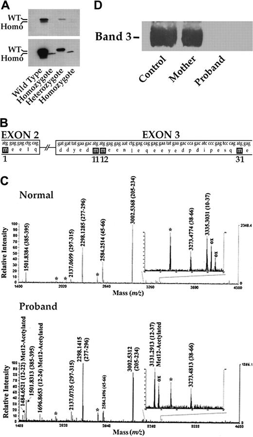 Figure 2. Band 3 Neapolis protein analysis. (A) Immunoblotting of tryptic fragments of band 3. Red-cell membranes were digested by trypsin, and band 3 in the supernatant fraction was purified using an immunoaffinity column. The fraction eluted with 1 M glycine, pH 3.0 was analyzed by immunoblotting, using antibodies directed against band 3. The top panel shows the results from a short exposure of film, while the bottom panel represents a longer exposure. (B) The potential ATG start sites in exon 3. (C) Mass spectrometric analysis of normal and mutant band 3. Each of the derived signals was characterized on the basis of its molecular mass and protease specificity. Asterisks indicate peptides generated from endoprotease AspN autoproteolysis. (D) Immunoblotting of band 3. Equivalent amounts of red-cell membranes were analyzed by immunoblotting, using monoclonal antibodies directed against N-terminal amino acids (clone CDB3). Note complete absence of the band 3 epitope in red-cell membranes of the proband.