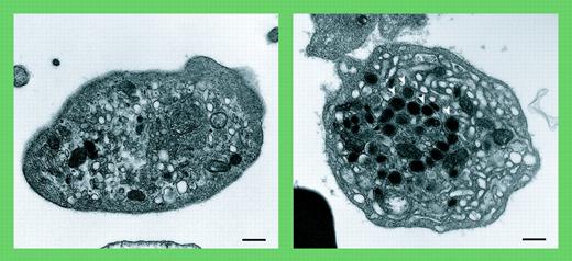 Absent α-granules in platelets from patients containing mutations in VPS33B. See the complete figure in the article beginning on page 4159.