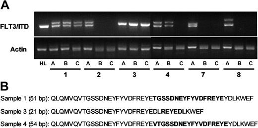 Figure 3. FLT3/ITD mutations in the bone marrow cells of engrafted mice. CD34+/CD38- cells from 6 different patient samples were isolated by immunomagnetic sorting (sorting results displayed in Figure 1). Mice were injected with either 1 × 106 unsorted cells or 5 × 103 CD34+/CD38- cells. After 14 weeks, the mice were killed and bone marrow cells were harvested. (A) For each of the 6 samples (numbers correspond to those in Figure 1), genomic DNA was isolated from the unsorted cells (a), the marrow cells of mice injected with 1 × 106 unsorted cells (b), or those mice injected with 3 × 105 CD34+/CD38- cells (c). PCR was performed using primers flanking the juxtamembrane region of human FLT3 (along with actin controls). The characteristic doublet of the FLT3/ITD mutation is easily visualized after electrophoresis in 2.5% agarose with ethidium bromide staining. Genomic DNA from HL60 cells (HL) was used as a control. (B) The sequences of the FLT3/ITD mutations from the 3 samples that engrafted (1, 3, and 4) are shown. These sequences, obtained from the DNA of the engrafted mice, matched the sequences of the mutations present in the preinjection samples. bp indicates base pair. Boldface sequence refers to the inserted, duplicated material.
