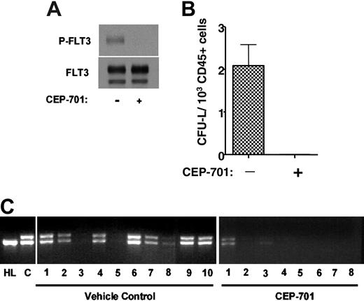 Figure 4. CEP-701 inhibits engraftment of FLT3/ITD cells in NOD-SCID mice. (A) Immunoblot of leukemia blasts (from patient sample 1) incubated for 1 hour in culture medium with or without 50 nM CEP-701. The blots were probed with antiphosphotyrosine antibody (top blot), then stripped and reprobed with anti-FLT3 antibody (bottom blot). (B) CFU-L assay. NOD-SCID mice injected with 5 × 103 CD34+/CD38- cells obtained using immunomagnetic selection of the sample shown in panel A were treated with vehicle only or with CEP-701. At 14 weeks, the mice were killed. Bone marrow cells harvested from engrafted mice were cultured in methylcellulose medium for CFU-L formation. Each column on the graph represents the average number of colonies obtained from all marrows within a treatment group. The number of colonies is expressed per 1 × 103 human CD45 cells plated. Error bar represents SD. (C) Genomic DNA was prepared from bone marrow cells and PCR was performed to amplify the juxtamembrane region of FLT3, yielding the characteristic doublet of the mutant gene. Following electrophoresis in 2.5% agarose, the ethidium bromide-stained gels were visualized under ultraviolet light. HL indicates control DNA obtained from HL60 cells (which harbor only FLT3 wild type); C, control DNA from the unsorted leukemia sample prior to injection into mice.