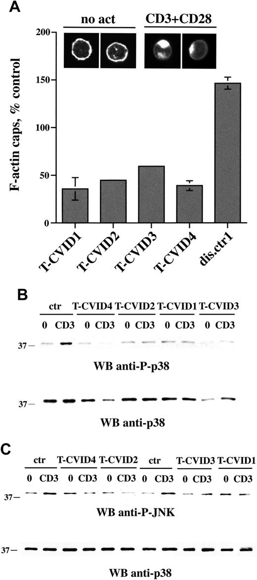 Figure 3. F-actin capping is impaired in T-CVID T cells. (A) Relative percentage of F-actin cap formation in PBLs from the 4 patients with T-CVID and a disease control patient (expressed as percentage capping in PBL from healthy controls; n = 6), as measured by confocal microscopy of cells labeled with fluorochrome-conjugated phalloidin. Error bars represent SD. Representative examples of F-actin labeling in cells not stimulated (no act) or activated for 1 hour by CD3/CD28 costimulation are shown at the top. (B-C) Immunoblot analysis of p38 (B) and JNK (C) phosphorylation using phosphospecific antibodies of postnuclear supernatants of PBL from patients with T-CVID and 1 or 2 representative healthy controls (ctr). 0 indicates nonstimulated; CD3, activated by CD3 cross-linking with OKT3 mAb for 5 minutes; and WB, Western blot. Filters were probed with anti-phospho-p38 or anti-phospho-JNK antibodies and, after stripping, with anti-p38 antibodies as loading control.