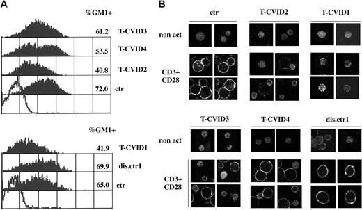 Figure 5. T-CVID T cells fail to up-regulate surface GM1. (A) Flow cytometric analysis of GM1 expression in PBL from the 4 patients with T-CVID (T-CVID1-4), 1 disease control patient (dis.ctr1), and 2 representative healthy controls (ctr; n = 4). Cells were activated for 27 hours by CD3/CD28 costimulation. Empty histogram shows the negative control (anti-CtxB and fluorochrome-labeled anti-mouse immunoglobulin; no CtxB). GM1 labeling in nonstimulated cells was not significantly higher than the negative control (not shown). Relative percentages of GM1+ cells and their mean fluorescence intensity are indicated. Results of representative experiments are shown (n ≥ 2). (B) Analysis of GM1 expression by confocal microscopy of PBL from patients with T-CVID (T-CVID1-4), 1 disease control patient (dis.ctr1), and 1 representative healthy control (ctr; n = 4). Cells were activated for 48 hours by CD3/CD28 costimulation or not (non act). Representative images are shown. Each experiment was performed 2 to 3 times.