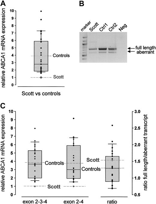 Figure 1. Relative expression of ABCA1 mRNA in leukocytes. (A) Quantitative analysis of ABCA1 mRNA using TaqMan technology and a fluorescent probe located in exon 3. Analysis was performed using the standard curve method. The control population is visualized by the box plots indicating the 10th and 90th percentile (error bars), the median (solid horizontal line), and the mean (dashed line). The relative amount of ABCA1 mRNA in each control is represented as x-fold expression of the SS patient (set as 1, dashed line). Measurements were performed in triplicate. Because ABCA1 mRNA expression did not differ between men and women, a mixed control population is shown. (B) Agarose gel electrophoresis (1.5% agarose gel) of RT-PCR products amplified from leukocyte RNA from the SS patient and 2 controls using primers spanning exon 1-6. The 2 bands correspond to the wild-type (746-bp) and the alternatively spliced (606-bp) transcript. Lane 1, 100-bp marker; lane 4: negative control. (C) Quantitative analysis of the 2 transcripts described in panel B using LightCycler technology. The SS proband showed reduced ABCA1 mRNA levels for both the appropriately spliced (exon 2-3-4) and the alternatively spliced (exon 2-4) transcript. The ratio of the 2 transcripts did not differ between the patient and the controls (column 3). Analyses were performed using the FitPoints calculation method as described in “Patients, materials, and methods.” The control population is visualized by the box plots (details are described in panel A).