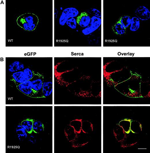 Figure 4. Expression of ABCA1-EGFP fusion proteins in HEK 293 cells. (A) Confocal sections of transiently transfected HEK 293 cells expressing wild-type ABCA1-EGFP (left) and ABCA1 R1925Q-EGFP (middle and right). EGFP fluorescence is shown in green and DAPI staining of nuclear DNA in blue. The mutation caused severe alteration in ABCA1 trafficking to the plasma membrane as compared to the wild type (WT). (B) HEK 293 cells expressing wild-type ABCA1-EGFP and ABCA1 R1925Q-EGFP were stained for SERCA 2 (red) as marker for the ER. The same confocal sections are shown for EGFP (green, left column), SERCA 2 (red, middle column) and colocalization of EGFP and SERCA 2 in the overlay (yellow, right column). Colocalization of ABCA1-SERCA2 was observed in cells transfected with mutant ABCA1, implying retention of R1925Q in the ER. In contrast, wild-type ABCA1-EGFP localized predominantly to the plasma membrane and no colocalization was detected. Scale bar indicates 10 μm.