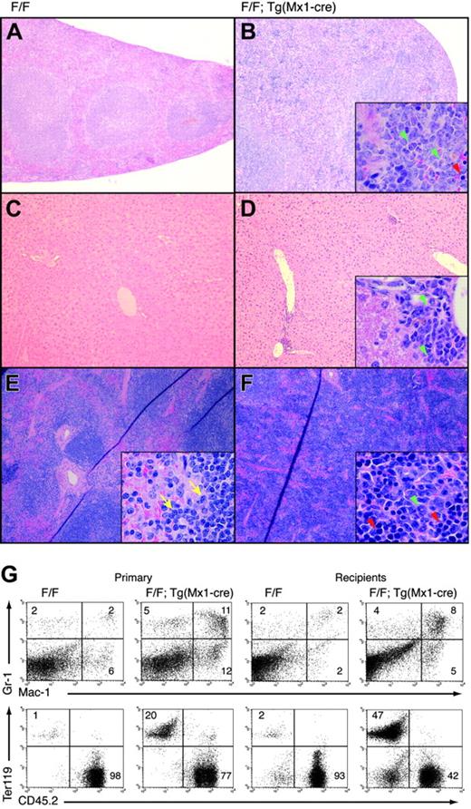 Figure 6. Runx1-excised mice display myeloid expansion in spleen and liver. Spleen (A-B) and liver (C-D) sections from representative (A,C) Runx1F/F and (B,D) Runx1F/F—Tg(Mx1-Cre) mice 143 days after pIpC (H&E; original magnification, ×100). Insets' original magnification, × 600. (E-F) Spleen sections from representative mice 14 weeks after transplantation with (E) Runx1F/F and (F) Runx1F/F—Tg(Mx1-Cre) marrow (H&E; original magnification, × 100). Insets' original magnification, ×600. (A-F) Yellow arrows indicate representative lymphocytes. Red and green arrowheads indicate representative erythroid and myeloid elements, respectively. Sections demonstrate the presence of extramedullary hematopoiesis in the liver and splenic red pulp in Runx1-excised mice, absent in nonexcised control animals. (G) Gr1/Mac1 and CD45.2/Ter119 staining of splenocytes of indicated genotype from representative primary mice or mice that underwent transplantation. Numbers indicate percentage of cells gated in each respective quadrant.