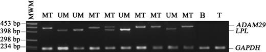 Figure 3. Multiplex PCR determination of LPL and ADAM29 expression. LPL and ADAM29 transcripts were amplified simultaneously; the PCR products were then separated by electrophoresis on agarose gel and visualized under UV illumination after ethidium bromide staining. Amplification of the GAPDH gene from the same transcripts served as control of cDNA integrity. MWM indicates molecular weight marker; MT, mutated; UM, unmutated; B, purified B cells from a healthy individual; T, Jurkat T-cell line.