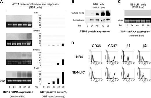 Figure 1. TSP-1 and its membrane receptors' expression in NB4 and NB4-LR1 cell lines. Maturation-sensitive NB4 cells and maturation-resistant NB4-LR1 cells were cultured for 4 days either untreated or treated with 1 nM to 1 μM ATRA or 1 μM ATRA and processed for examination of TSP-1 transcript (A, C) and protein level expression (B) or TSP-1 receptors' membrane expression (D). (A) Cell maturation was monitored by the NBT dye reduction assay. Total RNA (20 μg) was hybridized with a 32P-labeled fragment of human cDNA for TSP-1. Equivalent loading and integrity of each RNA preparation were evaluated by ethidium bromide staining of the 28S rRNA bands. (B) Triton X-100 cell lysates were prepared from maturation-sensitive NB4 cells and processed for immunoprecipitation and Western blotting for analysis of TSP-1 protein expression, as described in “Materials and methods.” Cell secretion of TSP-1 into the extracellular medium was similarly analyzed upon Triton X-100 solubilization of the corresponding culture media. Here, Triton X-100 cell extract and Triton X-100-solubilized culture medium coming from 4 × 106 NB4 cells and 1.2 × 105 NB4 cells, respectively, were analyzed. (D) Untreated (dotted line) or ATRA-treated (1 μM; bold solid line) NB4 and NB4-LR1 cells (2 × 105) were incubated with 20 μg/mL monoclonal antibodies to CD36, CD47, the β1 or β3 integrin subunit, or 20 μg/mL isotype-match control antibody (thin solid line). Alexa Fluor 488-conjugated anti-mouse IgG was used as secondary antibody (1:700), and cells were analyzed by flow cytometry.