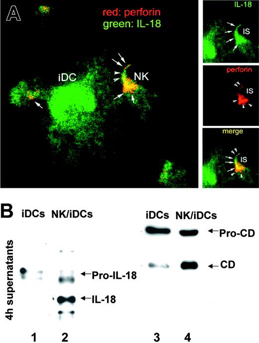 Figure 3. DC/IL-18 polarizes toward interacting NK cells. (A) Confocal microscopy analysis of perforin (red) and IL-18 (green) in an iDC/NK conjugate after 3 hours of interaction. Insets shows details of single and double fluorescence at the immunologic synapse. Arrowheads indicate perforin; arrows, IL-18. One representative experiment of 4 performed is shown. (B) Western blot analyses with anti-IL-18 (lanes 1 and 2) or anti-cathepsin D (CD; lanes 3 and 4) of 3-hour supernatants of iDCs cultured alone (iDCs; lane 1 and 3) or with NK cells (NK/iDCs; lanes 2 and 4). Arrows point to the precursors and mature forms of the 2 proteins. One experiment of 10 performed is shown.