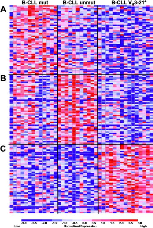 Figure 4. Three-group marker analysis in Ig-mutated, unmutated, and VH3-21+B-CLL. Results from the 3-group marker gene analysis, where the 50 genes best-correlated with either (A) Ig-mutated, (B) Ig unmutated, or (C) VH3-21+ B-CLL were identified. Gene lists are included in the Supplementary Materials.