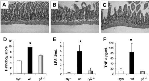 Figure 3. Absence of γδ T cells in the host reduces acute GVHD pathology. γδ-/- (▥, n = 4), wt (▪, n = 4), and syn BM transplant recipients (□, n = 4) underwent transplantation as in Figure 1 and the gastrointestinal tract was analyzed on day 7 after BMT as described in “Materials and methods.” Damage to syn small bowel was minimal (A), whereas wt exhibited severe villous blunting, crypt destruction changes and atrophy, and increased lymphocytic infiltrates (B). γδ-/- small bowel showed significantly less damage (C). Original magnification, ×100. Images were visualized using an Olympus Bx 40 microscope (Olympus, Melville, NY) equipped with an 10 ×/0.65 aperture objective lens. Image acquisition was performed with a JVC digital camera GC-Qx 5HDU (JVC, Wayne, NJ). Coded slides were scored for pathologic damage (D) as described in “Materials and methods.” Serum was obtained on day 7 after BMT and analyzed for LPS (E) and TNF-α (F). γδ-/- vs wt, *P < .05 (D-F). Error bars represent standard error.
