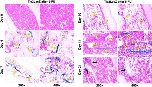 Figure 3. Vascular Tie2 expression is increased in a time-dependent manner after myelosuppression. Tie2-LacZ mice received a single tail-vein injection of 250 mg/kg 5-FU. Groups of mice were killed before the injection and 4, 7, 10, 14, and 24 days thereafter. Femurs were collected and prepared for histologic analysis by an X-Gal staining procedure. Paraffin sections were counterstained with NFR. Representative LacZ-NFR–stained sections at steady state and after 4, 7, 10, 14, and 24 days are shown. Regenerating neovessels consist of LacZ-positive endothelial cells, which are easily identifiable by their blue stain (yellow arrows). On day 4 after injection, these intensely LacZ-stained neovessels emerge at different sizes and shapes throughout the reconstituting BM (n = 15). The × 400 magnification clearly demonstrates that perivascular hematopoietic cells are not stained, but that LacZ positivity is limited to endothelial cells and their surroundings due to limited diffusion of the blue dye. By day 24, the only LacZ-expressing cells in the femur can be found in the epiphyseal region, consisting of few spindle-shaped endosteal cells (black arrows).