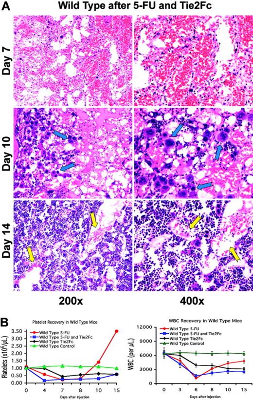 Figure 4. Angiopoietin trapping delays hemangiogenic recovery. (A) Disruption of the angiopoietin signal disturbs BM vascular remodeling after chemotherapy. Wild-type mice received a single tail-vein injection of AdTie2-Fc one day after a single tail-vein dose of 250 mg/kg 5-FU (n = 12). At the indicated time points, 3 mice were killed, and BM was obtained for histologic analysis. Hematoxylin and eosin–stained paraffin sections highlight vascular changes during hemangiogenic reconstitution. These histologic studies demonstrate that the inhibition of angiopoietin signaling after myelosuppression results in impaired assembly of neovessels with a delayed reconstruction of the BM microarchitecture. On day 10, there is an accumulation of polyploid megakaryocytes entrapped within the BM, dissociated from the sinusoidal endothelial cells, resulting in thrombocytopenia (blue arrows). In addition, on day 14, the newly formed sinusoids were still dilated and irregular, displaying features of unstabilized neovessels (yellow arrows). (B) Introduction of Tie2-Fc diminishes peripheral blood-cell concentration both at steady state and after myelosuppression. (Left) AdTie2-Fc results in a decrease of platelet levels by 60% to that observed at steady state (n = 6, P < .01 on day 7). Compared with control mice, AdTie2-Fc inhibits rebound thrombocytosis and delays thrombopoietic recovery after myelosuppression (n = 6, P < .02 at day 15). All data are expressed as the mean ± SEM. (Right) Similar changes are seen in the white blood cells (n = 6).