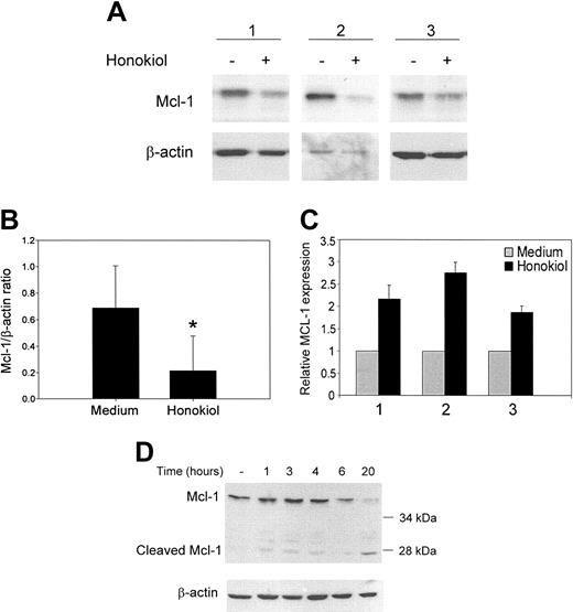 Figure 3. Honokiol down-regulates the survival protein Mcl-1. (A) B-CLL cells were incubated with 40 μM honokiol for 24 hours. Cells were lysed, and Western analysis was performed using antibodies that recognize Mcl-1. Blots were stripped and reprobed for β-actin as a loading control. Three representative patients' samples are shown out of 6 examined. (B) Films from the immunoblots were scanned, and mean intensities were calculated using Kodak Digital Science 1D image analysis software (Eastman Kodak, New Haven, CT). The ratio of Mcl-1 to β-actin was then calculated for cells treated with or without honokiol, and data are shown as mean ± standard deviation. *P < .02 when compared with cells treated with medium alone. (C) B-CLL cells treated for 3 hours with or without 40 μM honokiol were analyzed for Mcl-1 mRNA expression by real-time PCR using SYBR green technology Mcl-1 levels were normalized to β-actin. (D) B-CLL cells were incubated with 40 μM honokiol for the indicated times and then lysed and analyzed for Mcl-1 expression by Western blotting as described above.