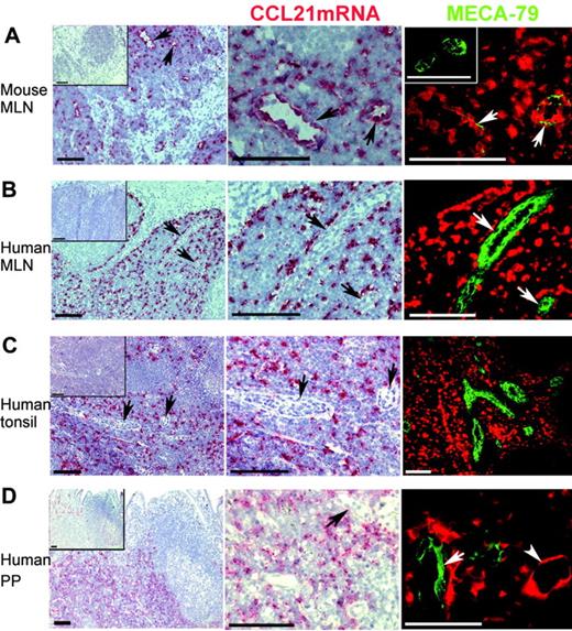 Figure 1. CCL21 mRNA is not detected in HEVs of normal human lymphoid tissues but is expressed in lymphatic endothelium and perivascular cells. In situ hybridization for CCL21 mRNA (red) and subsequent immunofluorescence staining for peripheral lymph node addressin (PNAd) with the monoclonal MECA-79 antibody (green) in normal mouse and human lymphoid tissues. Insets in left column display negative sense controls. Left and middle columns are light microscopic exposures in which PNAd expression is not visualized. Right column is merged color separation captured with the fluorescence microscope. (A) Numerous HEVs with strong CCL21 mRNA expression are detected in mouse mesenteric lymph node (MLN). HEVs (arrows) in left column are enlarged in the middle and right columns. Because of masking of epitopes by large depositions of biotinyl tyramide/Fast Red substrate at the site of CCL21mRNA, only thin streaks of PNAd expression are seen in these mouse HEVs (right), whereas more extensive PNAd expression is seen in the sense control (inset). (B) Extensive expression of CCL21 mRNA is seen in the T-cell zone of human MLN but is not detectable within HEVs. Negative HEVs (arrows) in left column are enlarged in the middle and right columns. (C) Extensive CCL21 mRNA expression is also seen outside HEVs in the T-cell areas in human tonsil. Negative HEVs (arrows) in the left column are enlarged in the middle column. No CCL21 mRNA is detected in the numerous MECA-79+ HEVs in the T-cell area (right). (D) Human PP with extensive CCL21 mRNA expression in T-cell areas. Vascular structures that express CCL21 mRNA are seen, but those with HEV morphology (arrow) are negative. CCL21 mRNA+ vascular structure with flat endothelium consistent with lymphatic vessel (lower right; arrowhead) is seen close to a MECA-79+ HEV (arrow), which is negative. Bar represents 100 μm except in the lower right panel, where it represents 50 μm.