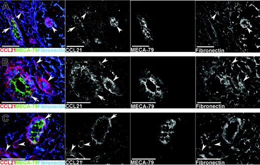 Figure 2. CCL21 protein is expressed in HEVs and is also associated with extracellular fibrils in normal human lymphoid tissues. Single-color separations in black and white and color merges of multicolor immunofluorescence staining for CCL21, PNAd (MECA-79), and fibronectin (see keys on panel). CCL21 immunostaining is seen in HEVs (arrows) in (A) normal mesenteric lymph node, (B) tonsil, and (C) PP. The strongest CCL21 staining in HEVs (arrows) is seen at the basal side, associated with the reticular network around HEVs, whereas MECA-79 staining in HEVs is strongest at the luminal face. CCL21 is also associated with the reticular network outside HEVs (arrowheads) at the sites of other vascular structures resembling lymphatics and elsewhere in the stroma.