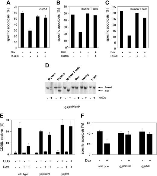 Figure 4. A GR monomer is not sufficient to mediate the antiapoptotic effect of GCs in T cells. DC27.1 T cells (A), primary murine day-5 T cells (B), and primary human day-6 T cells (C) were (re-) stimulated by anti-CD3 antibody in the presence or absence of 10-7 M Dex and/or 5 μM RU486 for 18 hours. Apoptosis was determined by FSC/SSC-FACS analysis. Results are for at least 4 independent experiments. (D) Southern blot analysis of the GR gene locus. Thymocytes, peripheral splenic T cells, and cells from liver, kidney, and brain were tested for successful recombination in GRloxP/loxP mice with or without expression of Cre-recombinase under the control of the lck-promoter (GRlckCre). Upper band: loxP-flanked locus (floxed); lower band: recombined locus (null). (E) Day-5 T cells from GRlckCre, GRdim, or control mice (GRloxP/loxP) were restimulated by anti-CD3 antibody for 8 hours in the presence or absence of 10-7 M Dex. CD95L protein expression on the cell surface was assayed by FACS analysis (n = 4). (F) Same as in panel E, but determination of apoptosis after 18 hours of restimulation (n = 3). Error bars are mean ± SEM.