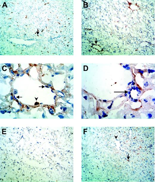 Figure 1. JAM-A expression in the hepatic microvasculature. Immunostaining for JAM-A was performed in cryosections of the murine liver. (A) Under control conditions, JAM-A expression was found in cells localized in liver parenchyma (arrow), but not in vascular endothelial cells. Magnification, × 200 (objective 20×/0.5). (B) In the postischemic liver, JAM-A expression was strongly expressed in the vessel wall of hepatic venules (arrow). Magnification, × 200. (C) Examination of JAM-A staining at higher magnification (× 1000 oil immersion objective 100×/1.30) shows JAM-A positively stained endothelial cells (arrows indicate spindle-shaped nuclei of endothelial cells) as well as JAM-A-expressing adherent leukocytes in the liver after I/R (arrowhead). (D) In bile duct epithelial cells (arrow), postischemic JAM-A expression was very weak and hardly detectable. Magnification, × 1000 oil. (E) No JAM-A expression was detected in JAM-A-/- mice after I/R. Magnification, × 200. (F) In postischemic livers of endothelial JAM-A-/- mice, JAM-A expression was found only in parenchymal (arrow) but not in vascular endothelial (arrowhead) cells. Magnification, × 200.
