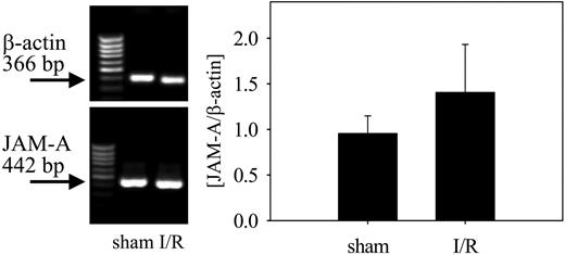 Figure 2. JAM-A mRNA expression. Representative RT-PCR gels (left) and the results of densitometric analysis presented as ratio of JAM-A to β-actin (right) show mRNA expression of JAM-A in hepatic tissue of sham-operated mice and mice after 90 minutes of hepatic ischemia and 140 minutes of reperfusion. The number of cycles was 35 for JAM-A and 23 for β-actin. n = 6 animals per group; mean ± SEM.