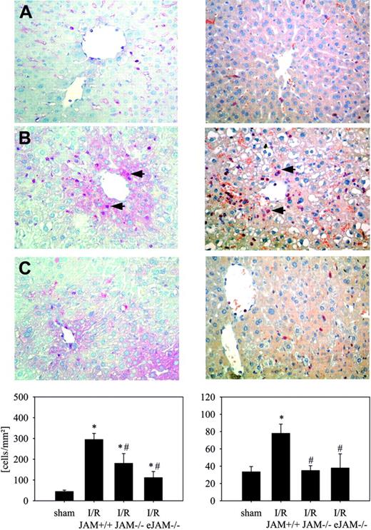Figure 4. Transendothelial migration of total leukocytes and neutrophils. Microphotographs demonstrate immunostaining for the common leukocyte antigen CD45 (left) and staining for granulocyte naphthol-ASD chloroacetate esterase (right) in the liver tissue of a sham-operated mouse (A), a JAM-A+/+ mouse after I/R (90/140 minutes) (B), and a JAM-A-/- mouse after I/R (C, top). Extravascular localized cells (arrows) were quantified in 10 high-power fields at microscope magnification × 400 (objective 40×/0.75) and (bottom) expressed as number of cells per square millimeter of liver surface (I/R-JAM+/+: JAM-A+/+ mice after I/R; I/R-JAM-/-: JAM-A-/- mice after I/R; and I/R-eJAM-/-: endothelial JAM-A-/- mice after I/R). n = 6 animals per group; mean ± SEM; *P < .05 versus sham-operated group; #P < .05 versus IR-JAM-A+/+ group.