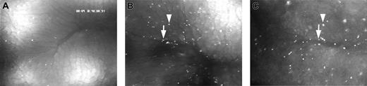 Figure 6. Platelet-endothelial cell interactions. The role of JAM-A for postischemic platelet-endothelial cell interactions was assessed using intravital fluorescence microscopy. Microphotographs in panels A and B demonstrate rhodamine 6G-labeled JAM-A+/+ platelets in the hepatic microcirculation of a sham-operated JAM-A+/+ mouse (A) and a JAM-A+/+ mouse after hepatic I/R (B). Photomicrograph in panel C shows JAM-A-/- platelets in the postischemic microvessels of a JAM-A+/+ mouse. Platelets adherent in postsinusoidal venules are marked by arrows; platelets accumulated in sinusoids are labeled by arrowheads. Monitor magnification, × 500 (water immersion objective 25×/0.6 W).