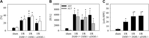 Figure 7. Microvascular and hepatocellular injury. (A) Sinusoidal perfusion was measured as a parameter of microvascular hepatic I/R injury. Microvascular perfusion failure is presented as the number of nonperfused sinusoids in sham-operated mice, JAM-A+/+ mice after I/R (I/R-JAM+/+), JAM-A-/- mice after I/R (I/R-JAM-/-), and endothelial JAM-A-/- mice after I/R (I/R-eJAM-/-). Ischemia time: 90 minutes; reperfusion time: 30 minutes (▪) and 120 minutes (□). (B) Serum activity of the liver enzymes AST and ALT was determined as a marker of hepatocellular necrotic injury after 90 minutes of ischemia followed by 140 minutes of reperfusion. (C) TUNEL-positive apoptotic hepatocytes were quantified in 10 high-power fields at microscope magnification × 400 in livers undergoing 90 minutes of ischemia followed by 140 minutes of reperfusion. n = 6 animals per group; mean ± SEM; *P < .05 versus sham-operated group; #P < .05 versus IR-JAM-A+/+ group.