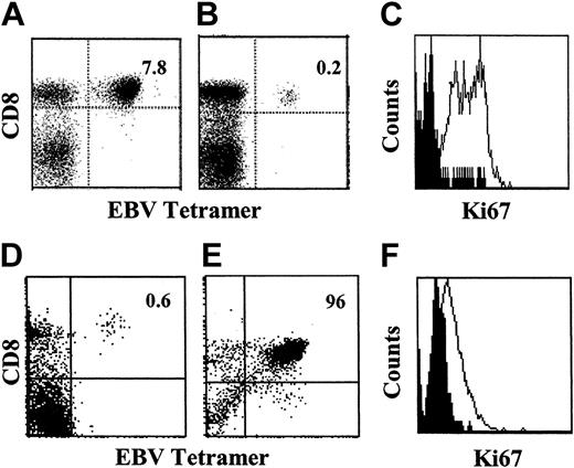 Figure 1. In vitro generation of EBV-specific CD8+ T cells. Peripheral blood mononuclear cells were isolated from donors with AIM (A) and from those who had recovered from AIM at least 1 year previously (B). The percentage of CD8+ EBV peptide (RAK)–specific T cells was determined by using HLA class I tetramers. (C) The cell-cycle status of antigen-specific T cells isolated during the acute phase of infection (open histogram) and those cells isolated from donors with chronic infection (filled histogram) were determined by staining cells with antibodies directed against Ki67. PBMCs isolated from donors with chronic infection (D) were stimulated in vitro with RAK peptide-pulsed autologous APCs plus exogenous IL-2 and maintained in culture for 4 weeks (E). (F) Proliferation was assessed by Ki67 staining in freshly isolated CD8+ tetramer+ cells (filled histogram) and in specifically activated CD8+ tetramer+ cells that were expanded for 1 month in vitro (open histogram). These results are representative of 6 separate experiments. (A, B, D, E) Numbers refer to percentages of tetramer-positive CD8+ cells.