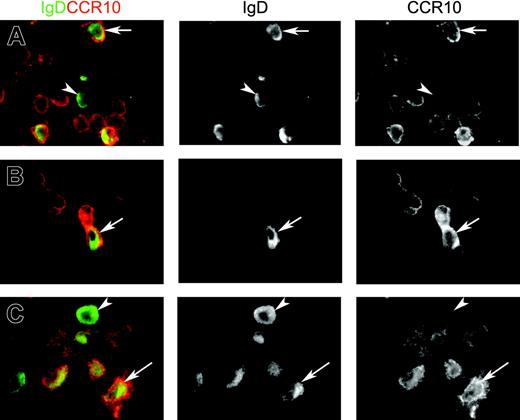 Figure 5. Merges and single-color separations of paired immunofluorescence staining for IgD (green) and CCR10 (red). The 3 depicted samples represent (A) adenoids (extrafollicular area), (B) salivary gland (normal parotid), and (C) nasal mucosa (glandular area). Many cells with variable peripheral CCR10 expression are seen, being particularly intense when showing a large plasmablast appearance. Some of these contain cytoplasmic IgD (arrows), but occasional clearly mature IgD+ plasma cells are completely negative for CCR10 (arrowheads). Magnification ×100.