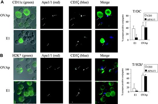 Figure 4. APA1/1 epitope discerns synapses of CD8+ T cells stimulated ex vivo with agonist but not with partial agonist peptides. (A, left) T-cell/DC synapses. Total spleen OT-I cells were incubated for 2 hours with 2 μM of the peptides indicated. T-cell/APC conjugates were identified in DIC images (left column) superimposed with the green marker. T-cell/DC synapses were visualized by antibody staining for CD11c (DC marker, green) and CD3ζ (T cell marker, blue). Exposure of the APA1/1 epitope is shown in red and indicated with arrows. (Right) Quantitation of T-cell/DC synapses. The percentage of T-cell/DC conjugates forming synapses positive for CD3ζ (□) and for APA1/1 (▪) is shown as the mean ± SD of 3 independent fields with a total of more than 30 cells for each data point. (B) Total T-cell/APC synapses. Samples of the experiment shown in panel A were labeled with the 25.D1.16 antibody, specific for OVA peptide-loaded H-2Kb, to detect all APCs bearing the OT-I TCR ligands. Quantitation of total T-cell/APC synapses was performed as in panel A. Images were acquired with a Zeiss Axiovert 200 microscope with a CCD camera.