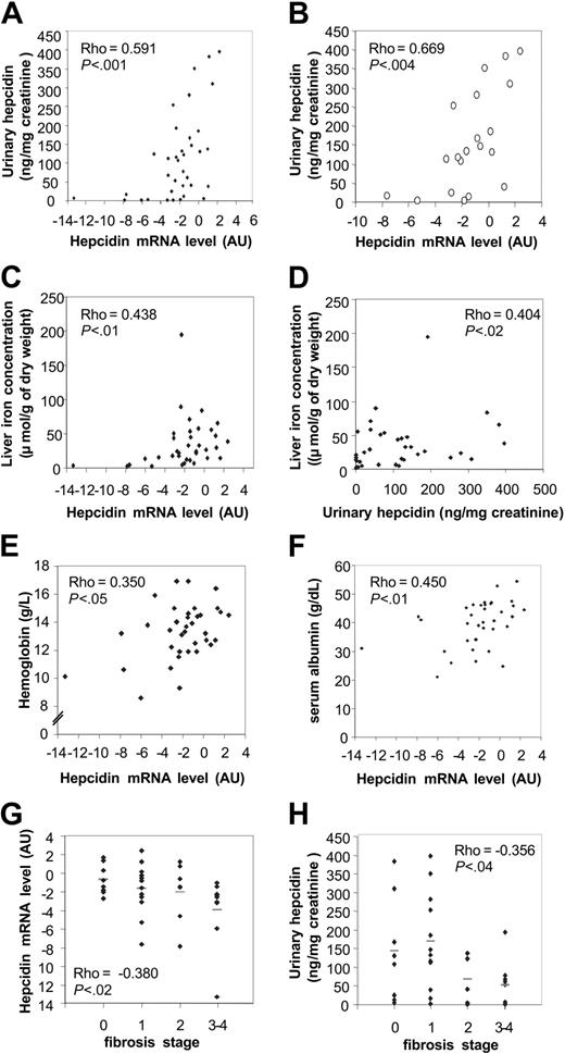 Figure 1. Correlations between hepcidin mRNA levels, urinary hepcidin concentrations, and clinical parameters. Urinary hepcidin levels expressed in nanogram per milligram urinary creatinine were correlated with hepcidin mRNA levels expressed in arbitrary units (log 2 scale) in the whole population of the 36 patients (♦; A) and within the subgroup of 20 patients with no or slight fibrosis (○; B). In our total population (n = 36) LIC was correlated with hepcidin mRNA (C) and urinary hepcidin (D) levels. Hepcidin mRNA level was correlated with blood hemoglobin value (E) as well as serum albumin level (F). Inverse correlations were found for hepatic fibrosis status and hepcidin mRNA (G) and urinary hepcidin levels (H). Horizontal bars correspond to the mean values.